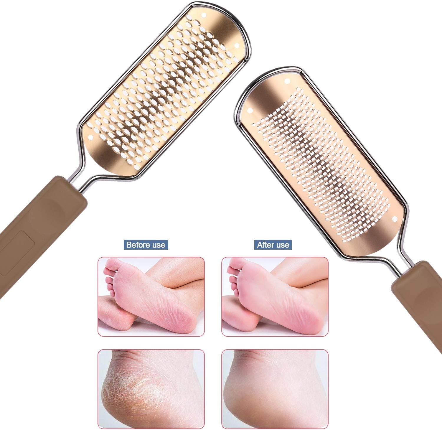 2 Pack Foot File & Rasp Callus Remover - Stainless Steel Coarse & Fine Scraper for Dry/Wet Feet, Professional Dead Skin Scrubber & Cracked Heel Care